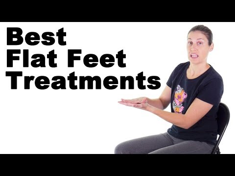 7 Best Flat Feet Treatments - Ask Doctor Jo