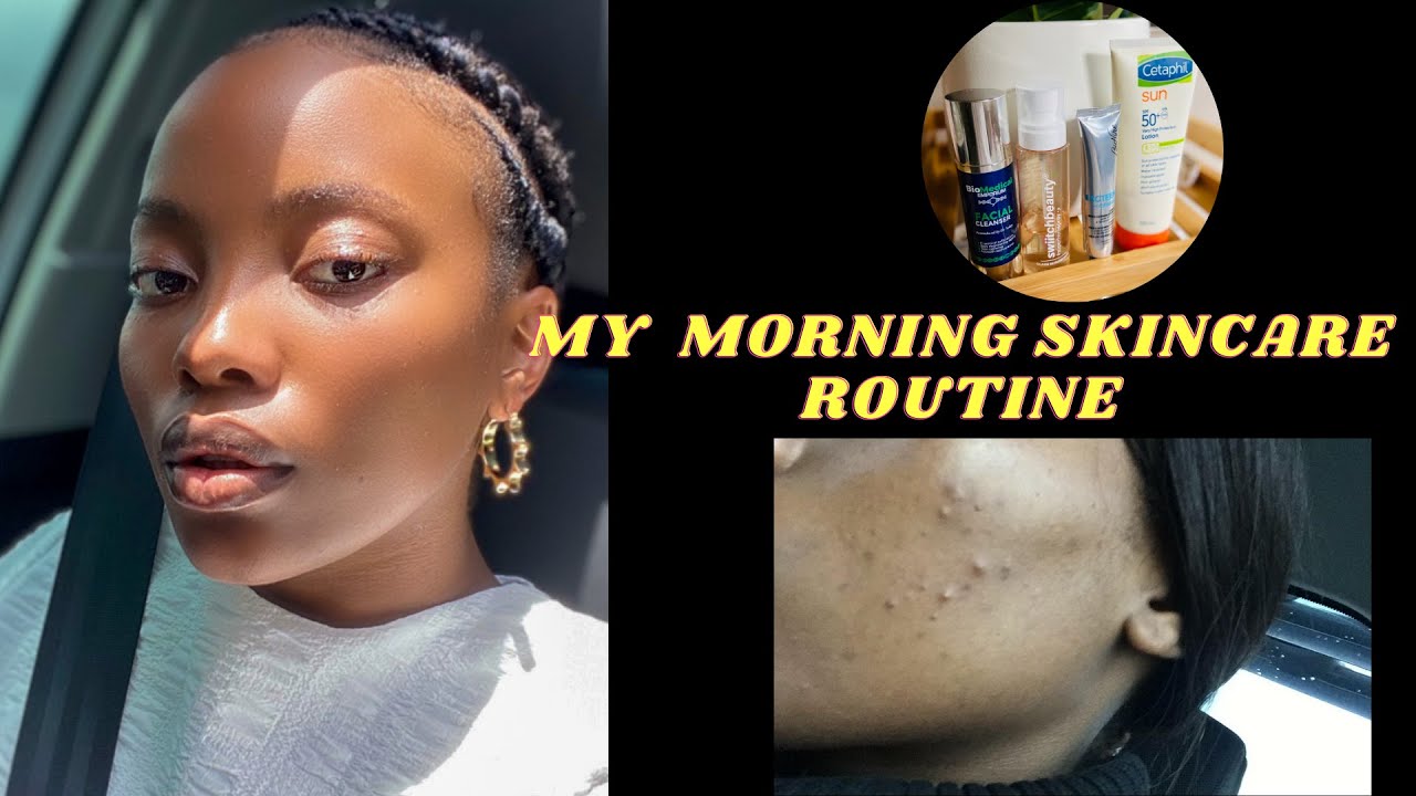 Skincare Routine + HOW I CLEARED MY ACNE | South African YOUTUBER - YouTube
