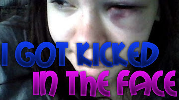 I GOT KICKED IN THE FACE