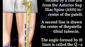 Q   Angle Of The Knee - Everything You Need To Know - Dr. Nabil Ebraheim