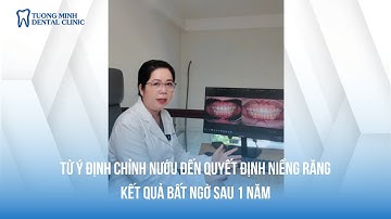 Từ ý định chỉnh nướu đến quyết đinh niềng răng và thay đổi bất ngờ | NHA KHOA TƯỜNG MINH #nhakhoa