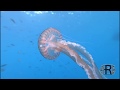 Picadura de medusa
