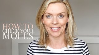 How to check your moles with Dr Stefanie Williams