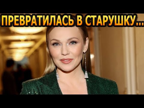 Ошарашила Видом! Что Случилось С Певицей Альбиной Джанабаевой