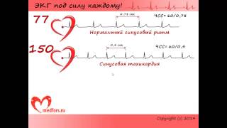 Урок 4. Видеокурс &quot;ЭКГ под силу каждому&quot;.