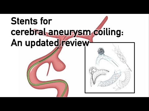 [English] Stent-assisted coiling for cerebral aneurysms: A brief and updated review