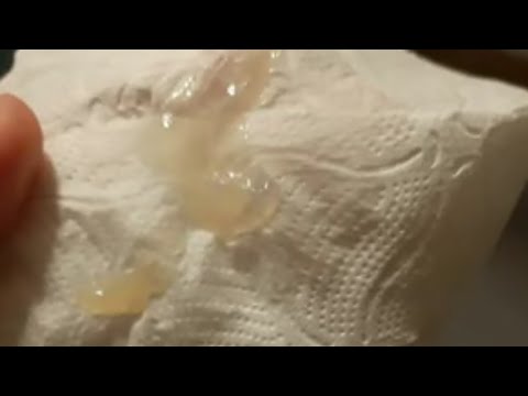 لو الشي ده نزل منك اعرفي أن الرحم عندك قلوي وإن نزل كده هيكون حمضي في بنت