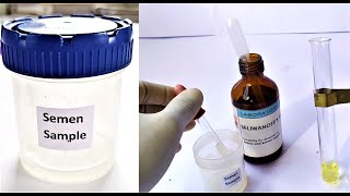 Semen Analysis Test Lab | Fructose Content test