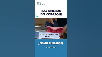 ¿Cómo desbloquear arterias obstruidas?