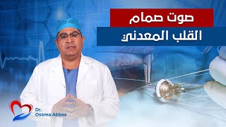 مشكلة صوت صمام القلب المعدني | دكتور اسامة عباس