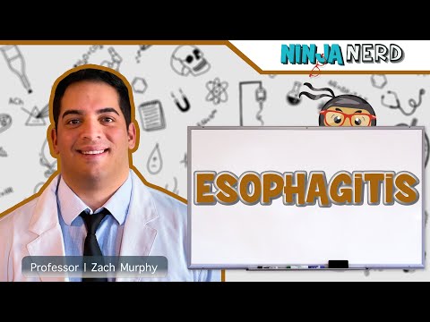 ቪዲዮ: Esophagitis እንዳለብዎ እንዴት ማወቅ እንደሚቻል (ከስዕሎች ጋር)