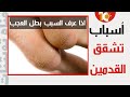 اسباب تشقق القدمين تشقق القدم احذر منها وتجنبها فوائد اسباب تشقق القدمين تشقق القدم اسباب تشقق القدمين تشقق القدم احذر منها وتجنبها فوائد اسباب تشقق القدمين تشقق القدم