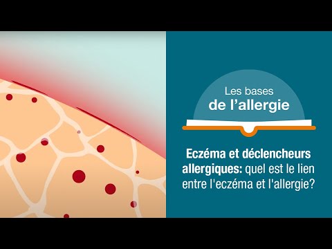 Vidéo: L'eczéma pourrait-il être causé par des allergies alimentaires ?