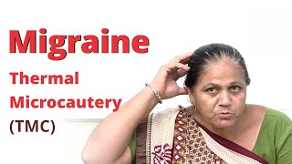 Extra-ordinary recovery in Migraine by Thermal Microcautery (Agnikarma) | Ayurveda Treatment