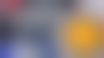 Intumescent cataract  Dr Sourabh D Patwardhan 3D live Phaco surgery.