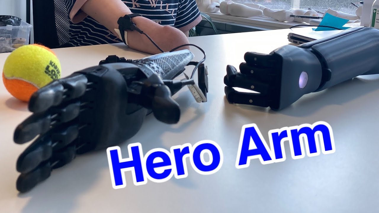 The Open Bionics Hero Arm - Never Give UP and be Inspired - Differently Abled