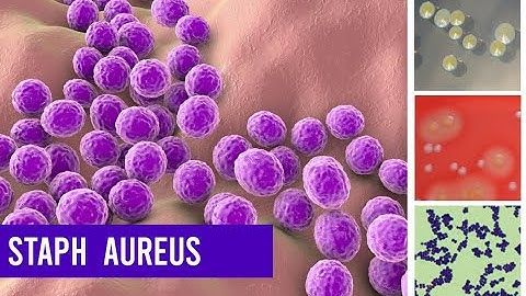 Staphylococcus Aureus Bacteria ( Complete Overview )