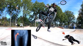 The Kid Just Can't Get A Break! |360 Whip Hip Destroyer|