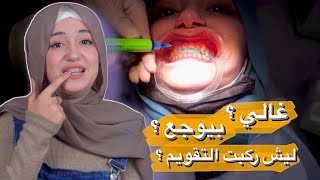 تجربتي كاملة مع التقويم بوجع ؟  كم سعرو ؟ 😬🦷