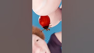 Can Eating a Tick Give You Lyme?😱🤔#shorts