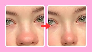 easy nose slimming exercises, reshape your nose in just 7 days!