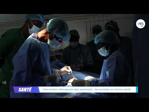 Intervention chirurgicale des siamoises : les jumelles en bonne santé