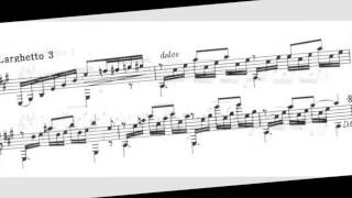 [Sheet Music Art] Matteo Carcassi Op.59 No.31, An Airy Hill
