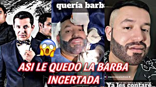 CHRISTIAN FELIX VOCALISTA DE MAXIMO GRADO SE PUSO BARBA ASÍ LE QUEDÓ