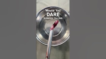 DARE to WATCH TILL END ? OPERATION SURGERY ? APPENDIX REMOVAL TREATMENT ?