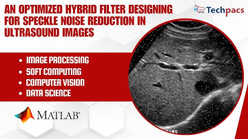 An Optimized Hybrid Filter Designing for Speckle Noise Reduction in Ultrasound Images.