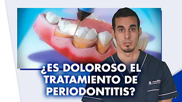 ¿Es dolorosa la terapia periodontal?