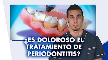 ¿Cuánto dura el raspado dental?