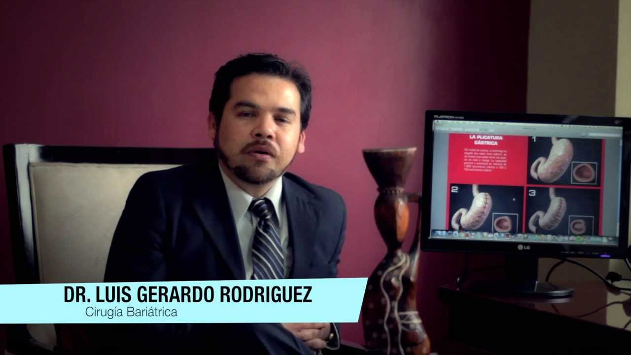 Qu Es La Plicatura G strica Dr Luis Gerardo Rodriguez Casta eda qu es la plicatura g strica dr luis gerardo rodriguez casta eda