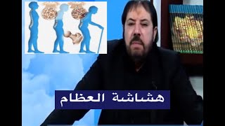 هشاشة العظام - الدكتور ابو علي الشيباني 191