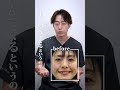クマ取り▶30代女性(上まぶたも凹んでいる方)
