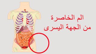 الم الخاصرة من الجهة اليسرى بين الاسباب والعلاج