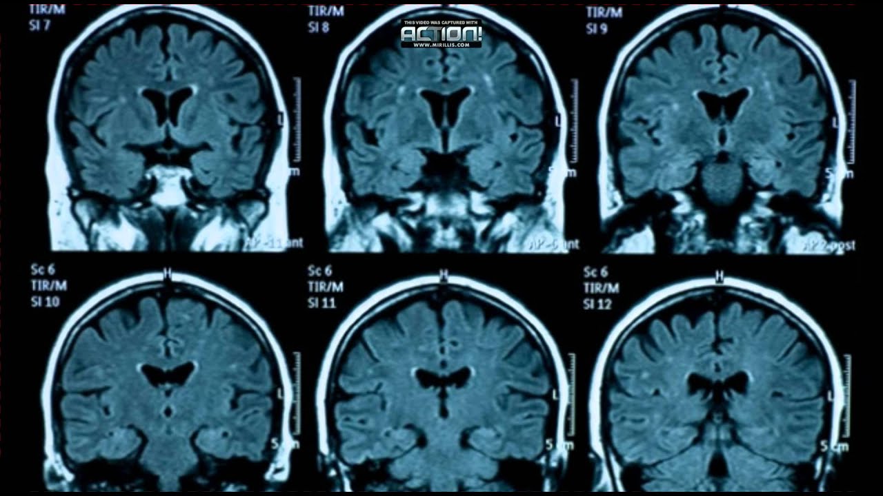 Human Brains Arent Distinctly Male or Female, Study Says Human Brains Arent Distinctly Male or Female, Study Says new photo Human Brains Arent Distinctly Male or Female, Study Says Human Brains Arent Distinctly Male or Female, Study Says new pictures