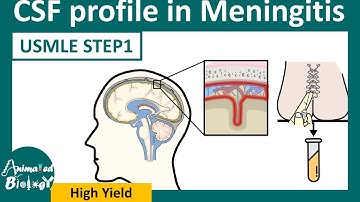CSF analysis in Meningitis | Easy way to remember CSF analysis in meningitis (flow chart)
