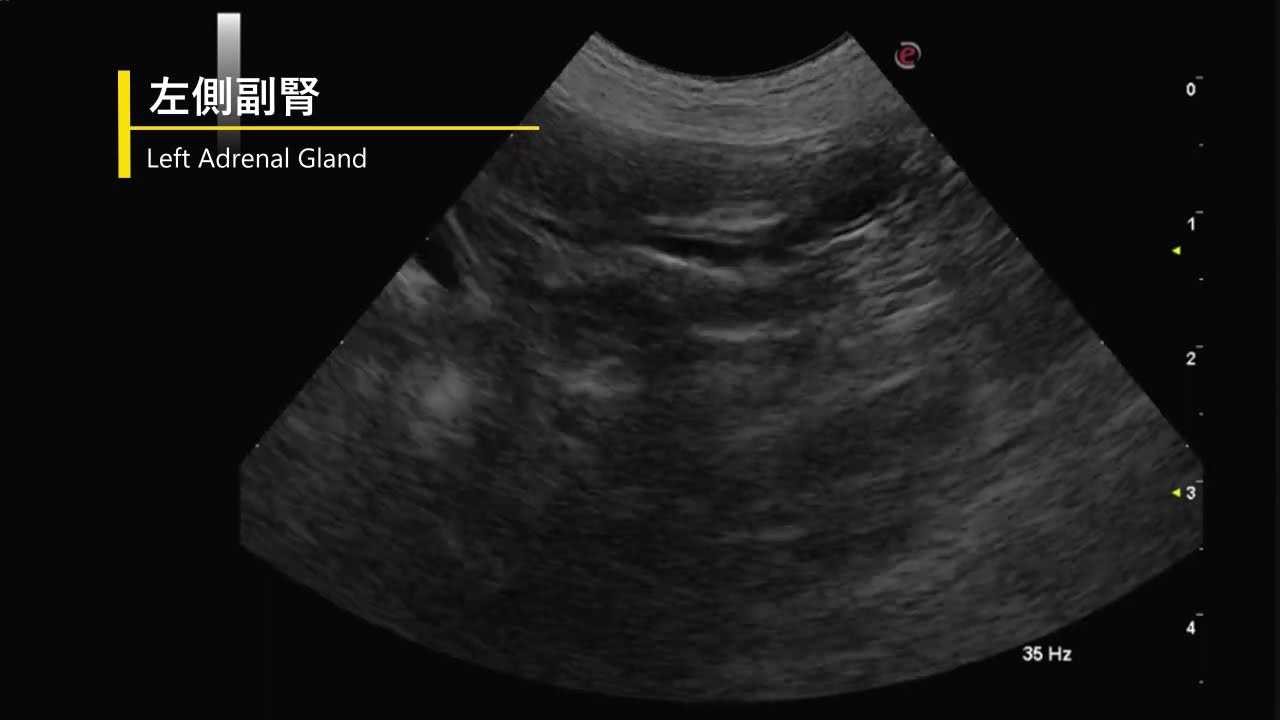 maxresdefault.jpg?sqp=-