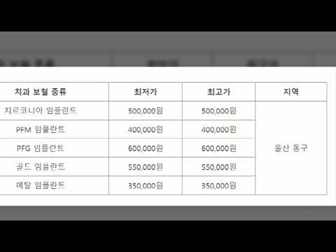 울산 동구 임플란트 유명한 곳 가격 잘하는 치과 추천 저렴한 싼 곳
