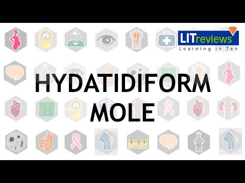 Hydatidiform Mole