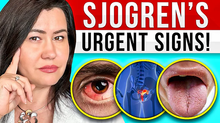 10 Signs of Sjogren's Syndrome | Dr. Diana Girnita