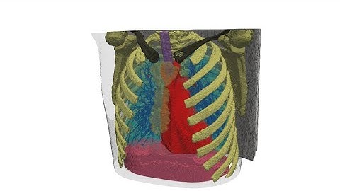 Segmentation for gVirtualXRay (Paraview animation)