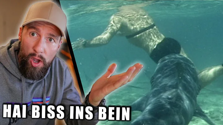 HAI beit einem Menschen die Wade ab - Wie konnte d...