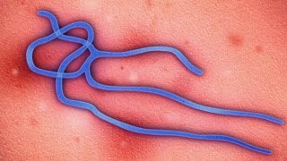 Ebola: How You Can Help Fight