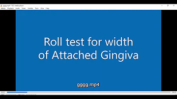 Which tooth has least attached gingiva?