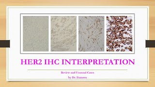 HER2 IHC Interpretation Guide (Examples and Challenging Scenarios)