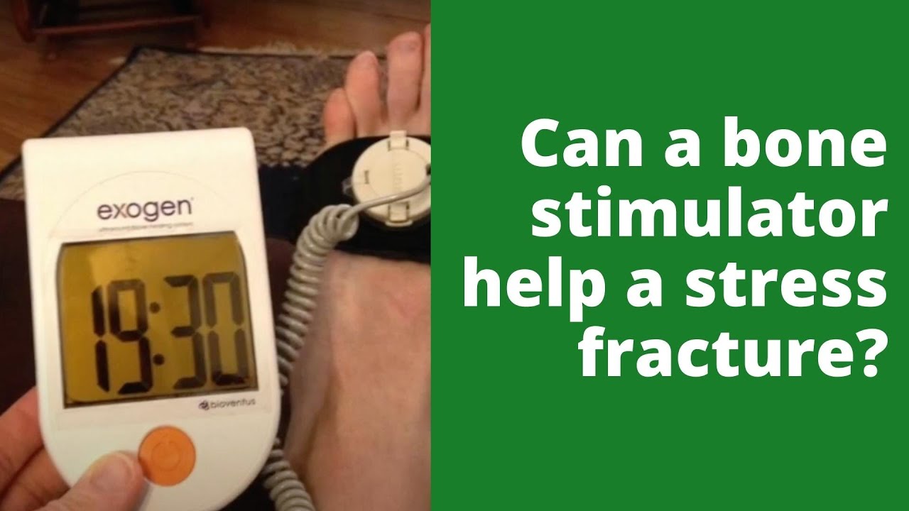 Can a bone stimulator help a stress fracture? 