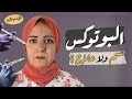 بوتوكس سم ولا علاج