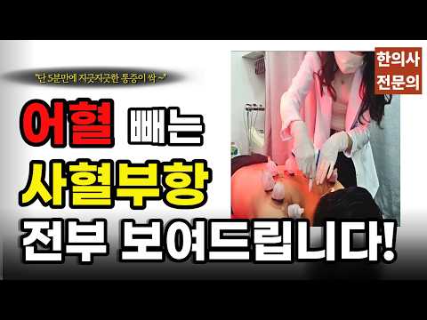 어혈 빼기 누구에게 필요할까